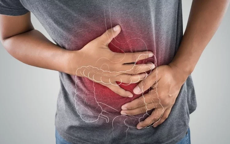 Cáncer de colon en Argentina: Sólo el 5% de la población mayor de 50 años se realiza un estudio preventivo