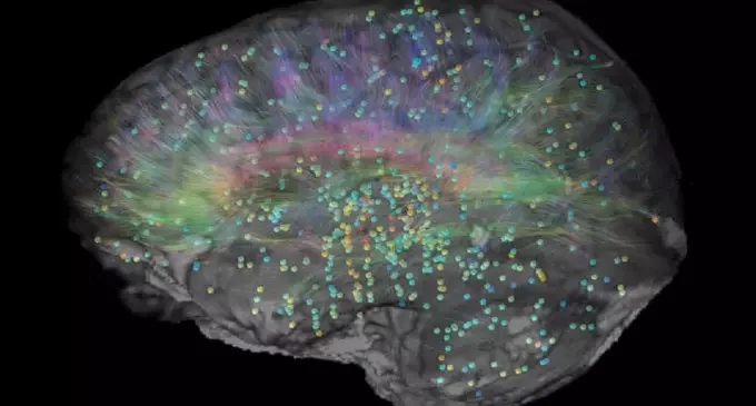 Las personas bilingües tienen más materia gris en el cerebro